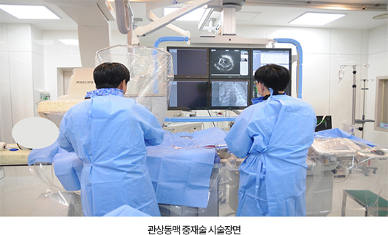 관상동맥 중재술 시술장면